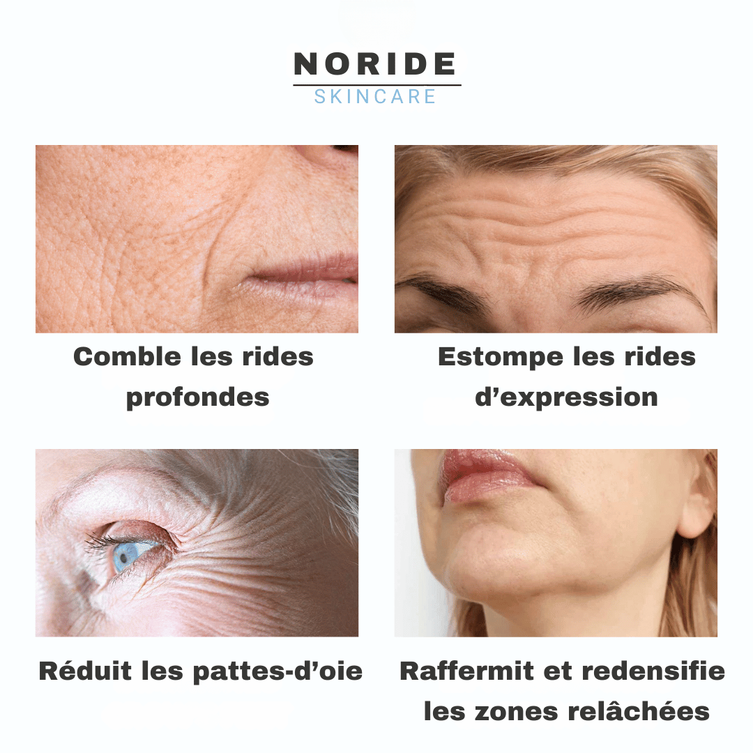 Cure de Collagène Sans Aiguilles